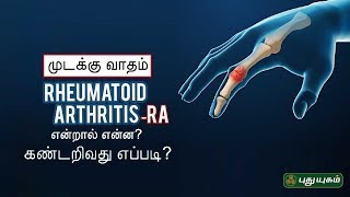 முடக்கு வாதம் என்றால் என்ன? கண்டறிவது எப்படி? Rheumatoid Arthritis | Doctor On Call | 13/09/2019