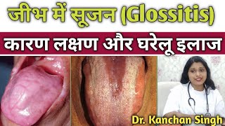 जीभ में सूजन (glossitis) के कारण लक्षण और घरेलू इलाज/home remedies for glossitis/ Dr. Kanchan Singh