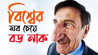 বিশ্বের সব চেয়ে লম্বা নাকের মানুষ || The longest nose on a living-Guinness World Records.