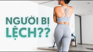 Người bị lệch? Cùng Na tìm hiểu nhé!