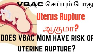 VBAC செய்தால் Uterus Rupture ஆகுமா? All about Most common fear of uterine rupture for VBAC Mom