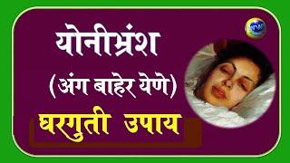 योनीभ्रंश (अंग बाहेर येणे) - घरगुती उपचार   Prolapse of the Vajina