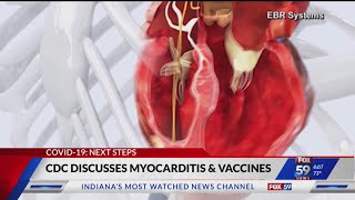 CDC discusses myocarditis and COVID vaccines