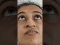 lipoma removal from forehead. tumor cosmeticsurgery