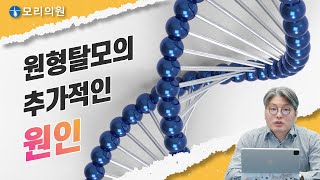 원형탈모의 추가적인 원인(유전, 기저질환, 수면장애, 호르몬 이상)