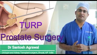 Prostate TURP I प्रास्टेट लेज़र सर्जरी  I HOLEP I Prostate Laser surgery I prostate Operation