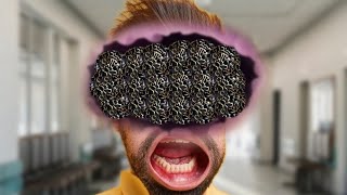 ASMR Apa yang Ada di Dalam Dagu | ASMR Remove Maggots from half face |