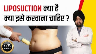 Liposuction For Weight Loss, Surgery Cost, Procedure, Side Effects, Tummy Tuck Abdominoplasty
