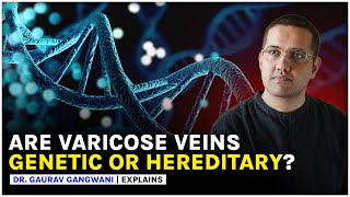 Veins disease hereditary | Are varicose veins due to genetic reasons? Dr. Gaurav Gangwani