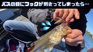 バスの目にフックが刺さってしまったら…