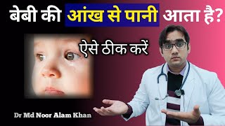 बच्चे की आंख से पानी आना || Watery eyes in babies || cause and treatment|| Dr Md Noor Alam Khan