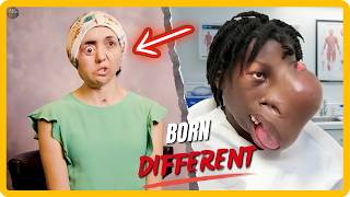 20 Rare People Whose Lives Left The World Speechless – Rare People