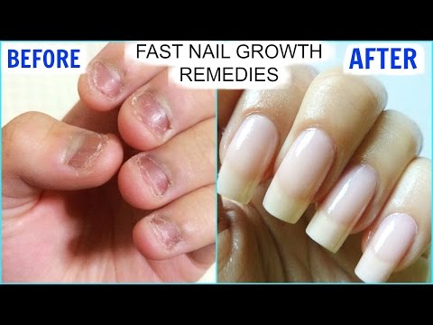 How To GROW Long Strong Nails Fast At Home | SuperPrincessjo How To GROW Long Strong Nails Fast At Home | SuperPrincessjo