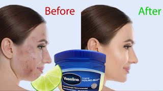 SKIN CARE : Apply VASELINE + Lemon For BEAUTIFUL Skin