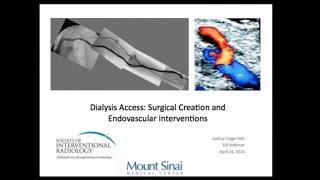 SIR-RFS Webinar (4/24/14): Dialysis Access Surgical Creation and Endovascular Interventions