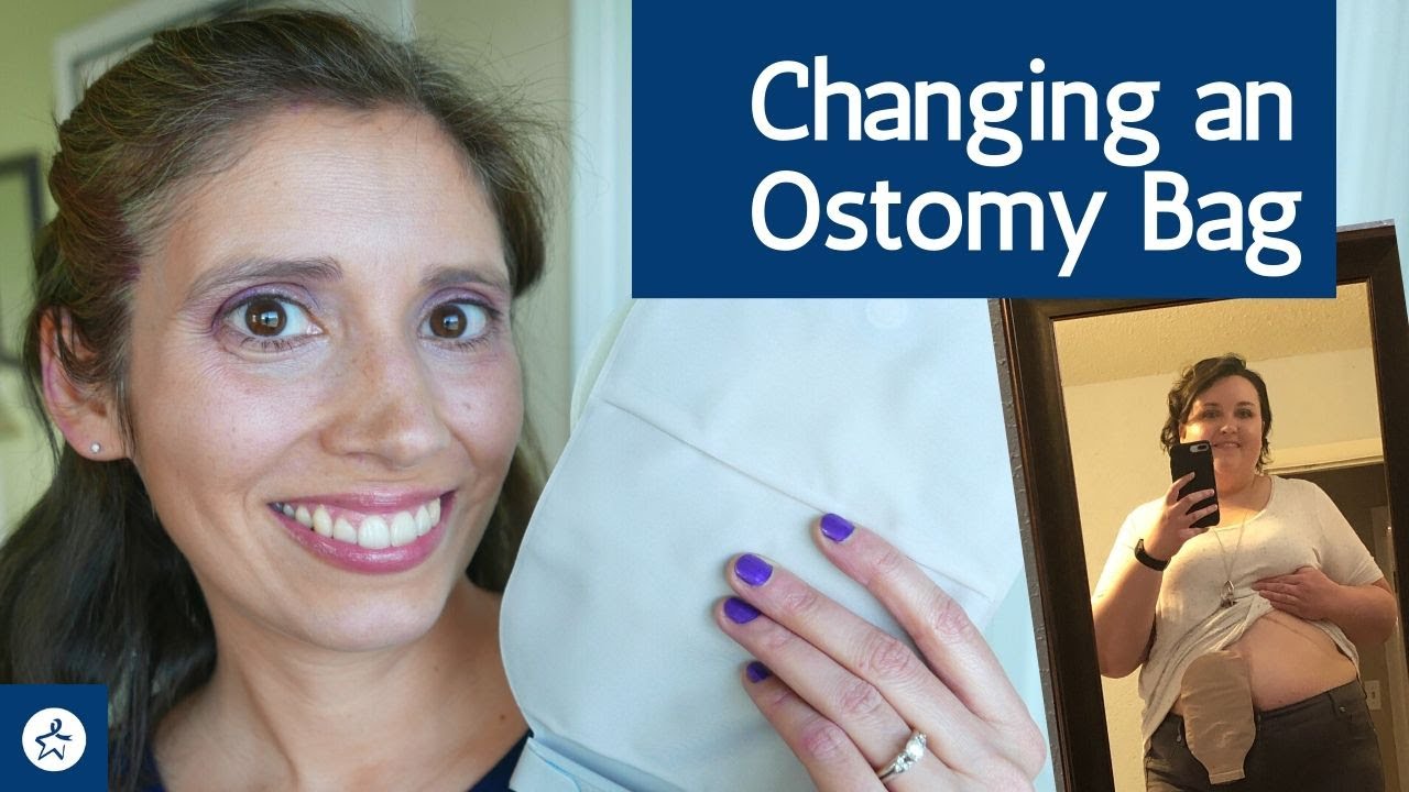 Changing A Colostomy And An Ileostomy Bag - YouTube