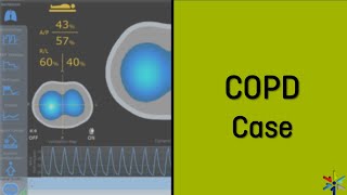 COPD Case