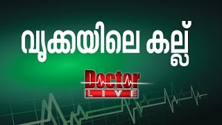 Kidney Stones | വൃക്കയിലെ കല്ല്‌  | Doctor Live 4 Apr 2017