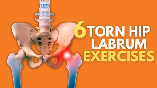 Top 6 Exercises For Naturally Healing A Painful Torn Hip Labrum