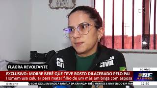 DF ALERTA - Exclusivo: morre bebê que teve rosto dilacerado pelo pai