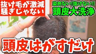 【抜け毛激減】頭皮をはがすだけで薄毛がフサフサになる頭皮下リンパ流しで白髪をなくす方法！目の下のたるみ・クマ・シミまで一瞬で解消するリンパマッサージで目の疲れが取れ視力回復するトレーニングで老眼を治す