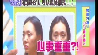 20160831請你跟我這樣過【罪惡行為?!害妳變大媽?!】 林上立液態拉皮上立提依戀詩Ellanse少女針聚己內酯PCL精華版