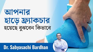 হাড়ের ফ্র্যাকচার হয়েছে কিনা বোঝার জন্য দেখুন পুরো ভিডিওটি | Bones Fracture | Dactar Babu | Ep.:555