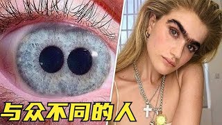 5个与众不同的人，有人天生两个瞳孔？有人眉毛连成一条线？