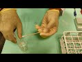 preparation of sputum for cytology