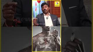 புகை பிடிப்பதால் உடலுக்கு வரும் பாதிப்பு !! | Aayushmaan hospitals |