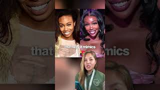 SZA Before & After Plastic Surgery ✨
