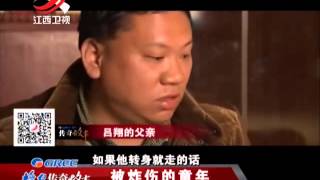 20150417 传奇故事  被鞭炮炸伤的童年 抗不起的医疗费