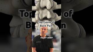 This Is Causing Your Back Pain Shorts