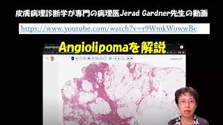 Angiolipoma病理組織の英語解説動画の日本語説明