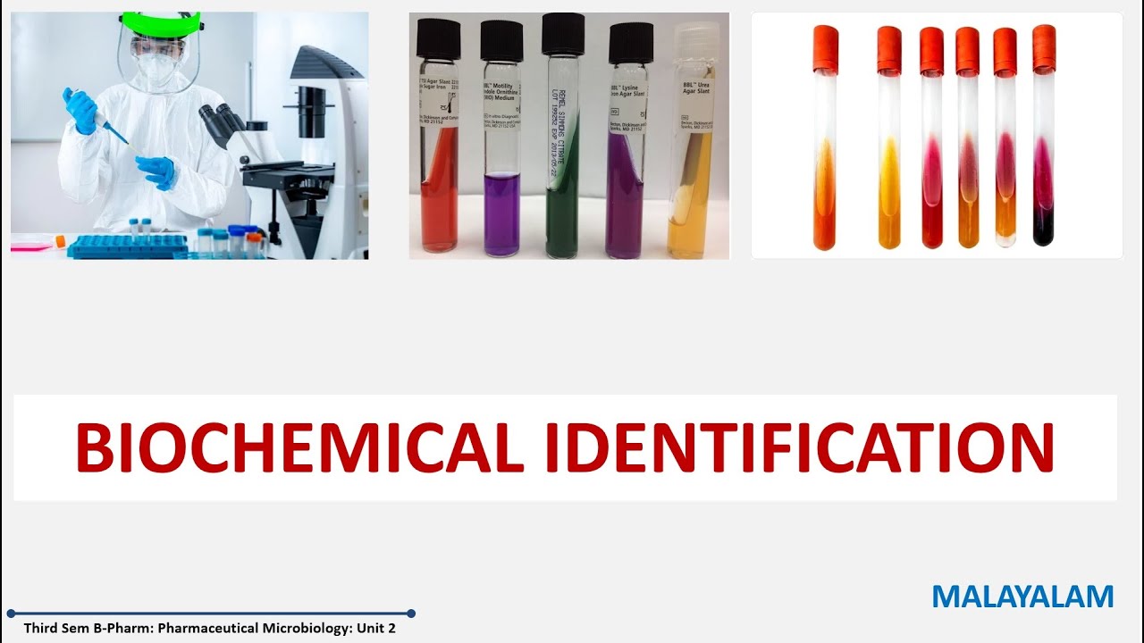 Identification Methods Of Bacteria Part 3: Biochemical Identification ...