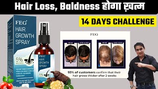 FEG Hair Growth Spray 14 Day Challenge for Longer, Thicker, Healthier Hair.  Stop Hair Loss