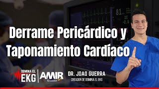 Derrame Pericárdico y Taponamiento Cardíaco