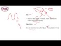 appsc group 1 prelims విపత్తు నిర్వహణ disaster management focus 30 upsc group1 group2 group4