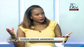 Thyroid Disease: Signs and symptoms to look out for