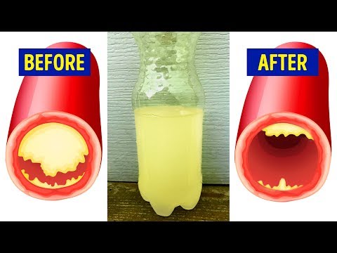 15 Foods That Reduce Your Heart Attack Risk by 80% 15 Foods That Reduce Your Heart Attack Risk by 80%