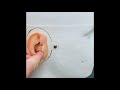 Inserting and Removing an In-the-Canal (ITC) Hearing Aid Using CARL