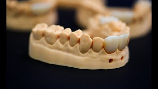 UnionTech EvoDent Series | 3D Printing Process for Dental Models