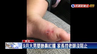 家長控9月大嬰遭霸凌成傷 托育中心:孩子互毆－民視新聞