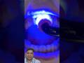 Amazing teeth transformation #smiledentists miledentist #trending #viralshort