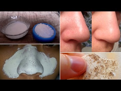 How to Remove Blackheads Naturally How to Remove Blackheads Naturally