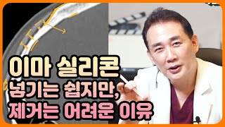 이마 실리콘, 넣기는 쉽지만 제거는 어려운 이유