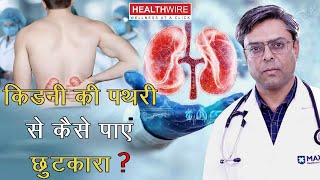 Kidney Stone Treatment: कैसे करे किडनी की पथरी ठीक? How to Get Rid of Kidney Stone | Dr. Varun Verma