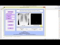 Image Compression using Improved SPIHT Matlab Project Code