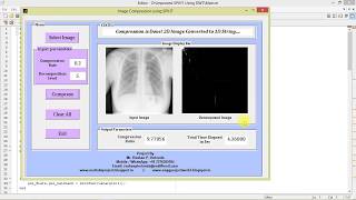 Image Compression using Improved SPIHT Matlab Project Code