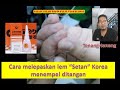 Cara melepaskan lem Alteco, lem “setan” atau lem Korea G menempel ditangan